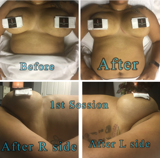 A before and after picture of the back of a person 's torso.